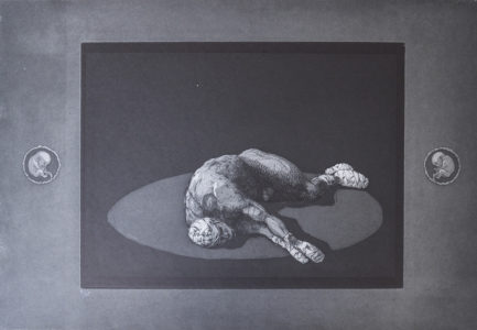 Kunsten til Sygdom, 1992